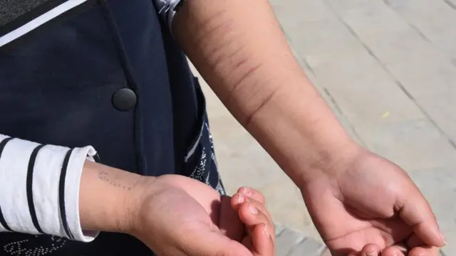 Руҳий қийноқлардан чарчаган Ирода ўткир тиғ билан ўзига жароҳат етказган