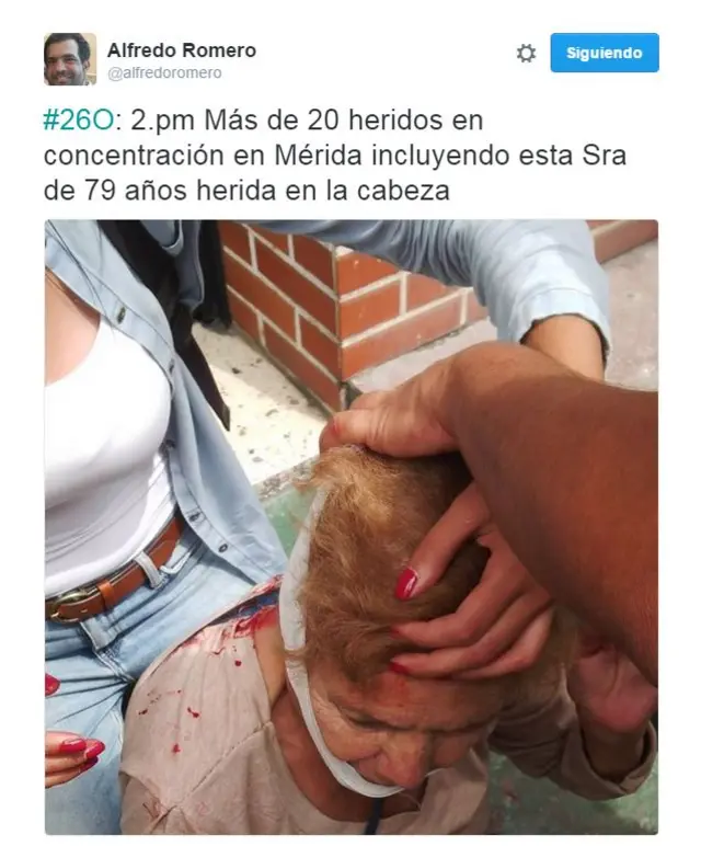 Una foto del Twitter de Alfredo Romero muestra a una señora mayor herida en la cabeza tras las protestas en Mérida, Venezuela.