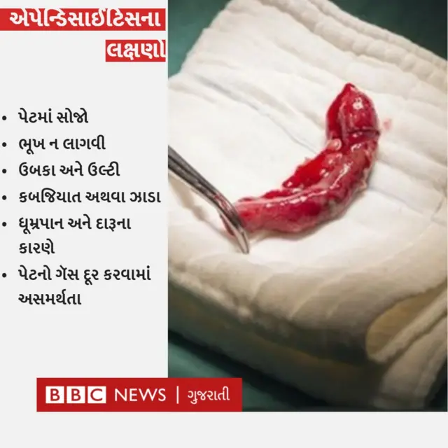એપેન્ડિક્સ