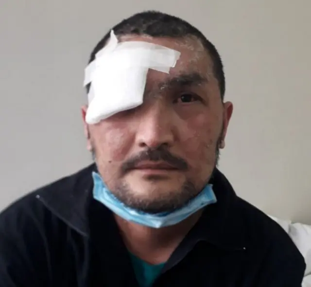 Qazaxıstan İğtişaşlar 