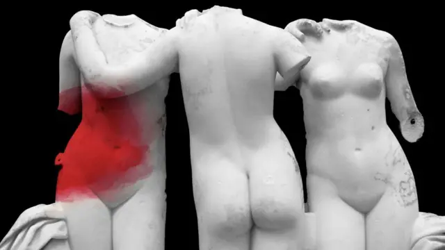 ਐਂਡੋਮੇਟ੍ਰੀਓਸਿਸ