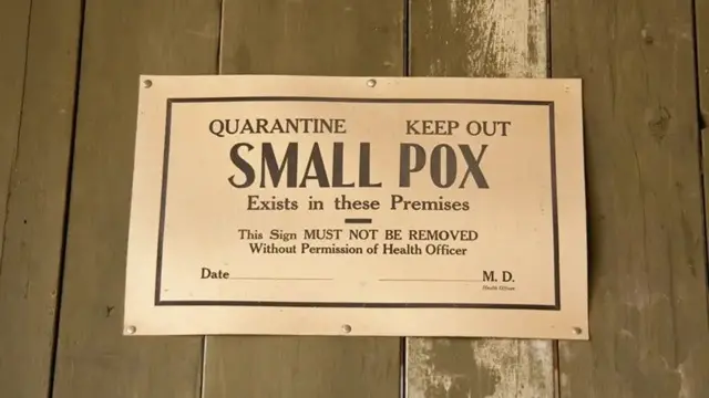Un signe pour la quarantaine des personnes atteintes de la variole
