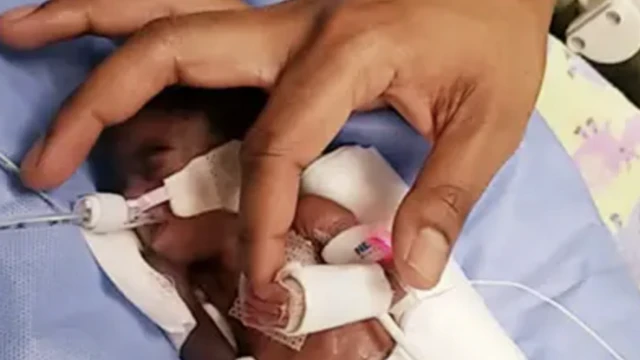 እናታቸውን የያዘች ጨቅላ