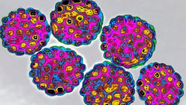 Yalangoch eshak rasmlar