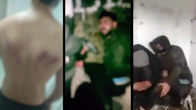 تصاویر شکنجه پناهجویان کرد ایرانی و آثار آن در جریان آدم‌ربایی که آنها را محو کرده‌ایم