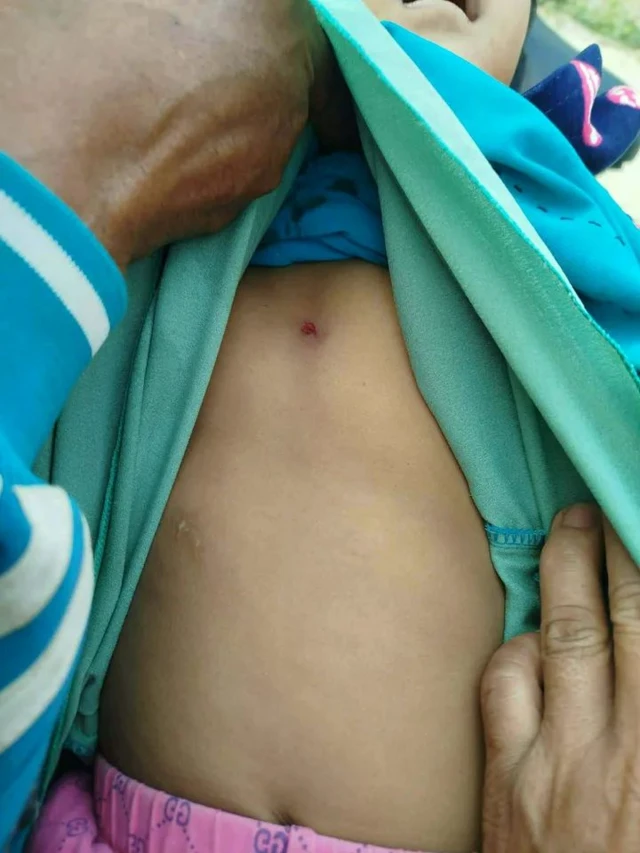 လုံးခင်းကျေးရွာအုပ်စု၊ မလန်းရွာက လက်နက်ကြီးကျည်ထိမှန်သေဆုံးခဲ့တဲ့ ကလေးငယ်