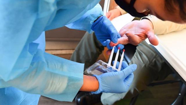 市場上還有其他的抗體檢測方法，也可以用手指刺血來採集血液樣本。