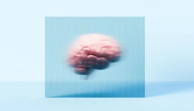 માઇગ્રેન એટલે શું, માઇગ્રેન કેમ થાય છે, માઇગ્રેન એટલે આધશીશી, માઇગ્રેન ઉપર અભ્યાસ, આધશીશીનો ઇલાજ અને સારવાર, સંશોધન, બીબીસી ગુજરાતી