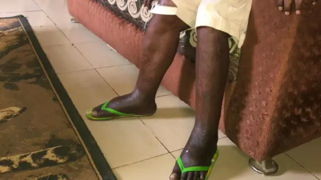 Charles Olumo agbako