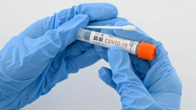 Prueba de laboratorio de covid-19.