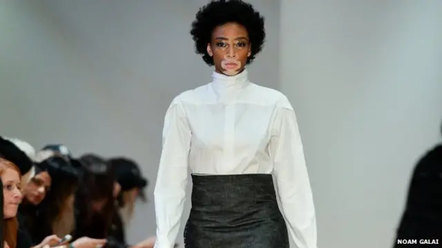 fashion model Winnie Harlow