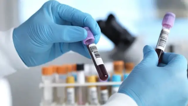 Nyocha ọbara bụ otu ụzọ ew si achọpụta ọrịa ahụ