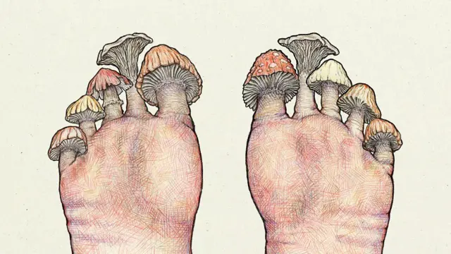 Fangasi husambaa na kuambukizwa kutoka kwa mtu mmoja hadi mwingine kwa kugusana na vitu vilivyotumiwa na mwenye vimelea aina ya fangasi.