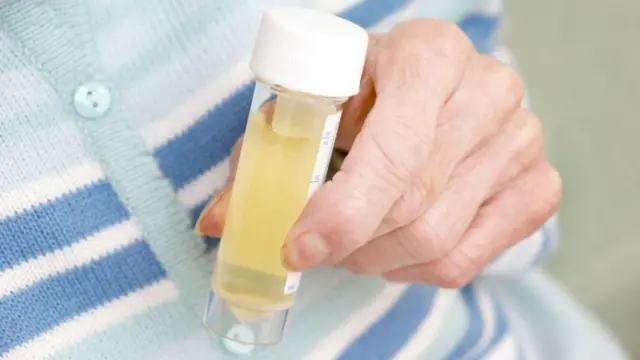 యూరినరీ ట్రాక్ట్ ఇన్ఫెక్షన్ 