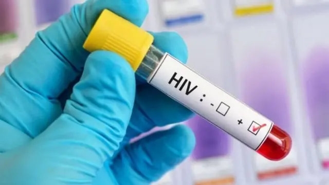 एचआईवी