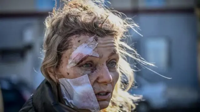 ኣብ ፈለማ ኲናት ዝቖሰለት ዩክሬናዊት