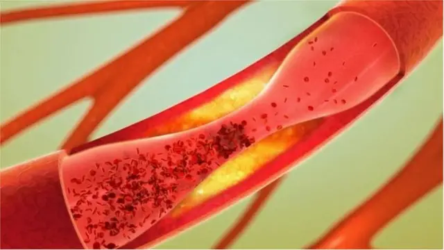 नपुंसकता