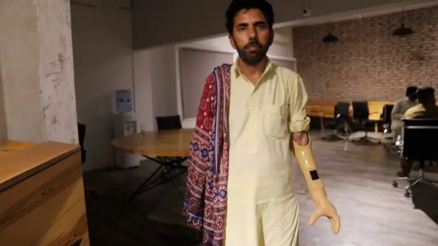 مصنوعی بازو