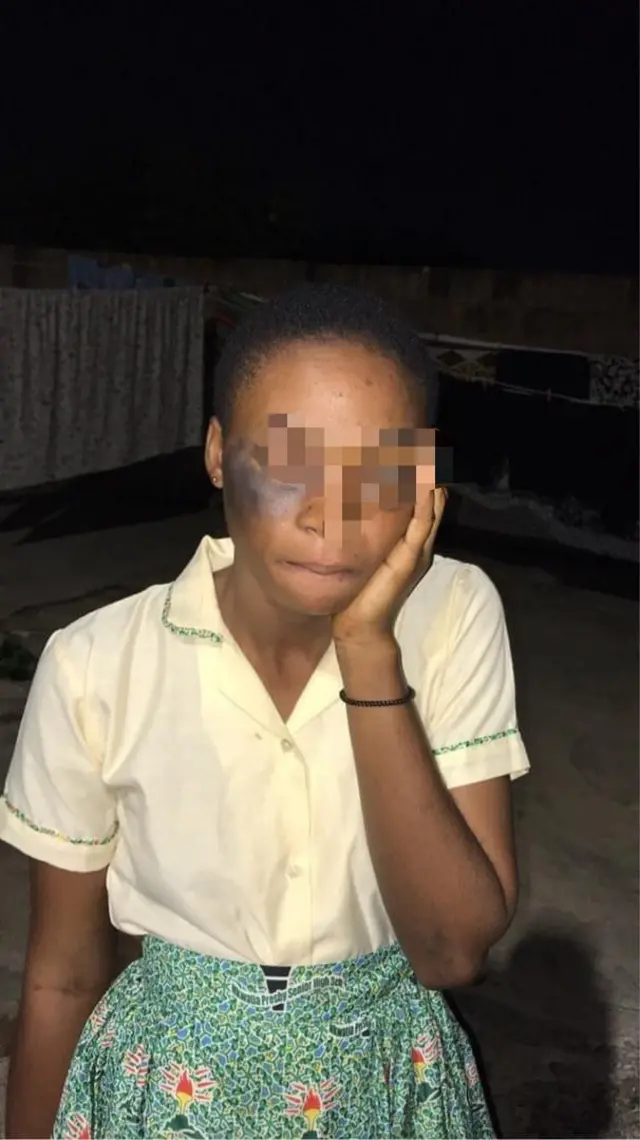 Female student wit black eye afta assistant headmaster assault am
