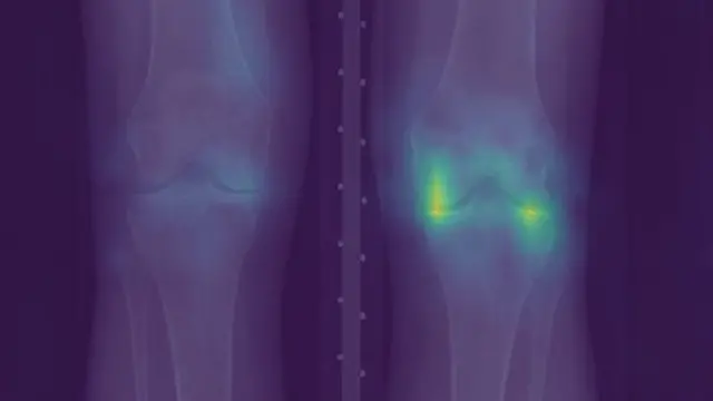 엑스레이 이미지