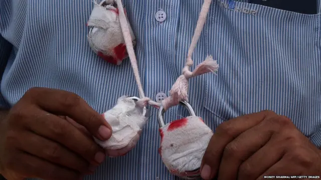 भारत की राजधानी दिल्ली में चल रहे सीलिंग अभियान के ख़िलाफ़ गले में सीलिंग युक्त तालों को लटकाकर प्रदर्शन करते एक व्यापारी