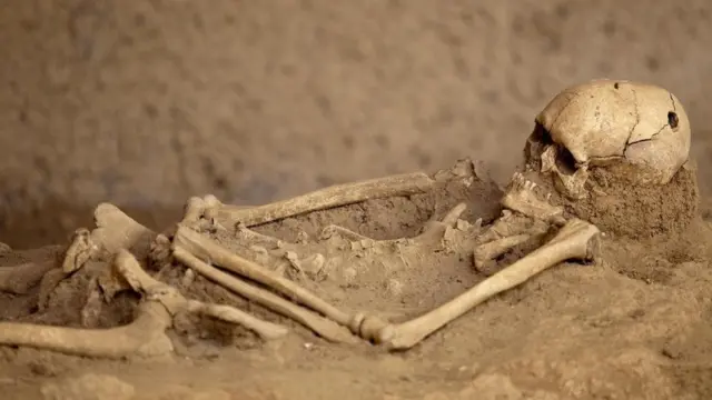 اسکلتی با جمجمه سوراخ شده