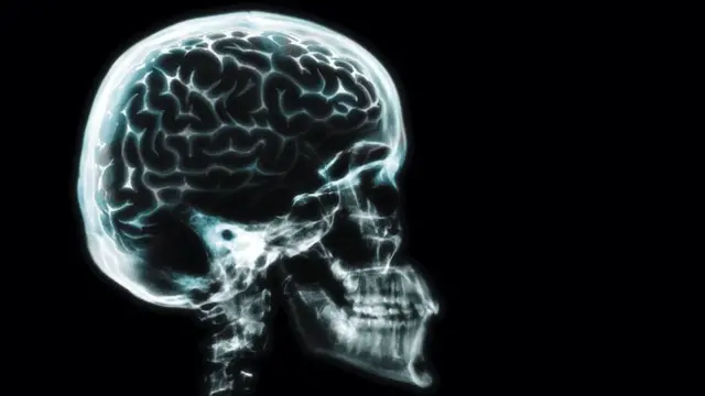 Мозок людини