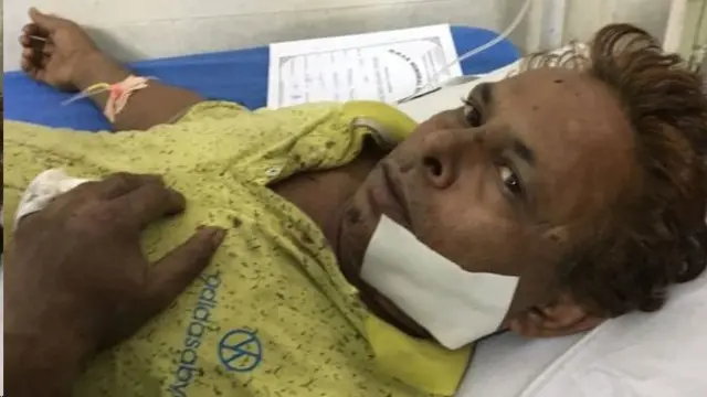 காயமடைந்த யாத்ரீகர்