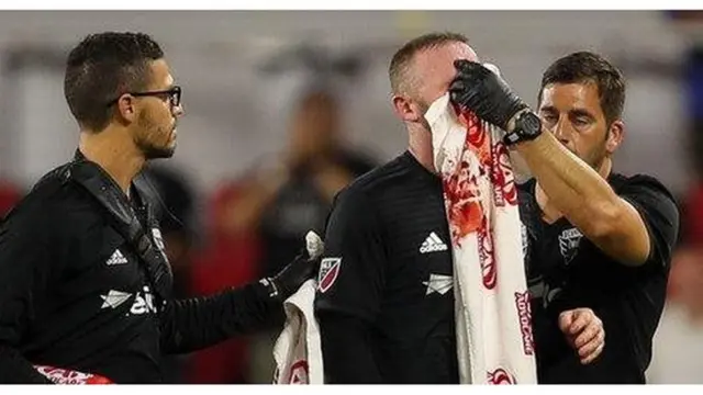 Rooney akipokea matibabu