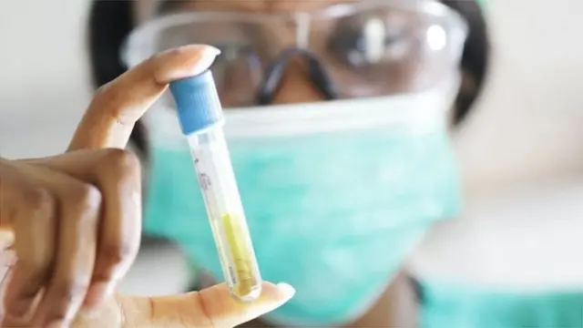 कोरोना चाचणी