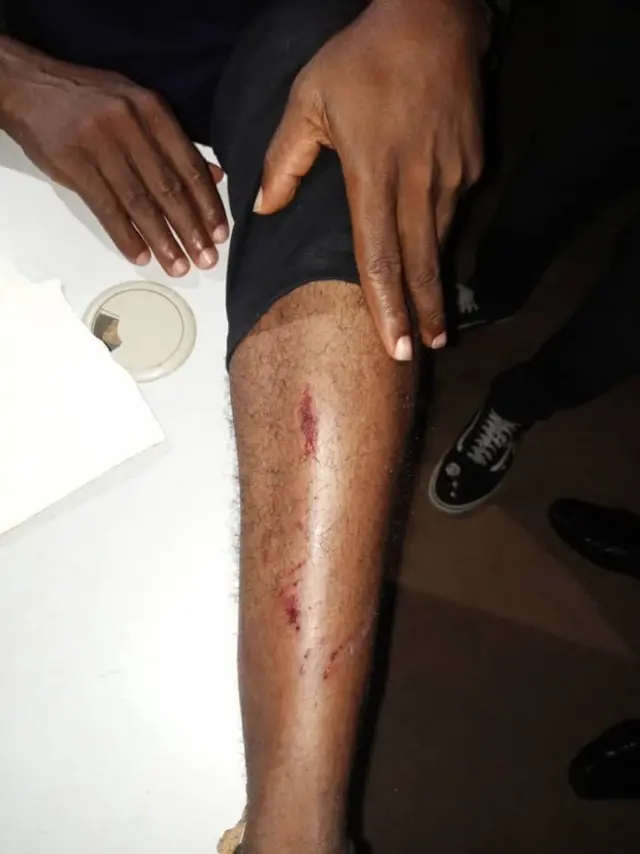 Aworan yii ni Họnọrebu Shuaib Ọladayọ fi ranṣẹ lati ṣafihan ifarapa to ni lasiko ija naa