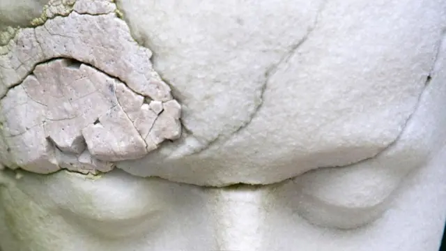 أول من وصف آلام الشقيقة التي تتركز في ناحية واحدة من الرأس هو طبيب إغريقي