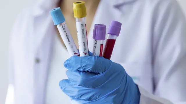 Igo awo fun coronavirus