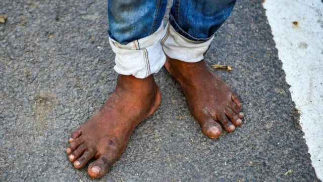 મજૂરના પગ