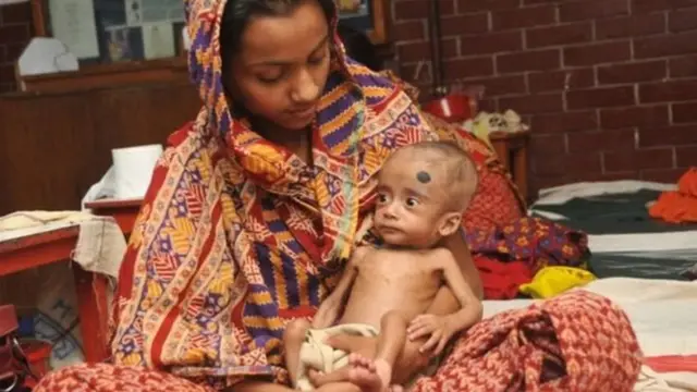 పోషకాహారలోపం