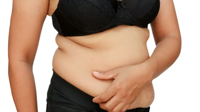 Mujer con sobrepeso.