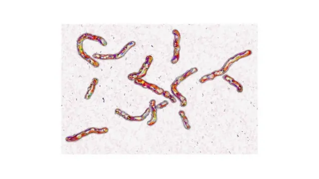 Nje na ebute ụkwara nta