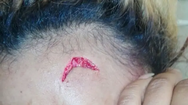 Sababu ya mwanamke huyo kushambuliwa haijulikani.