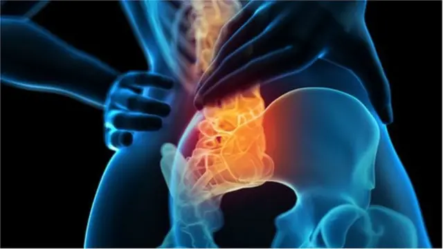 SEBASTIAN KAULITZKI/SCIENCE PHOTO LIBRARY