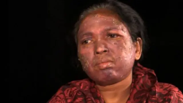 सोनी सोरी