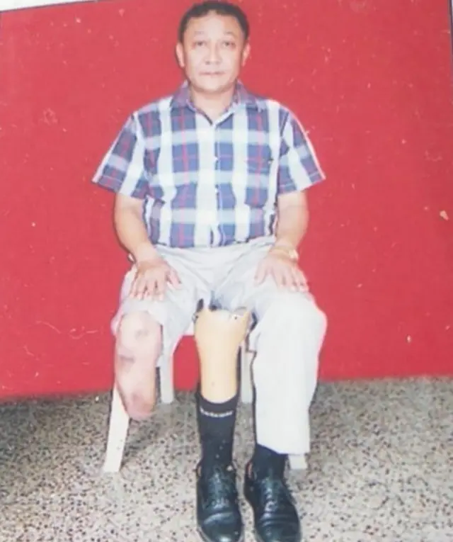 देवभक्त राई अहिले पनि कृत्रिम गोडाको सहाराले हिड्छन्