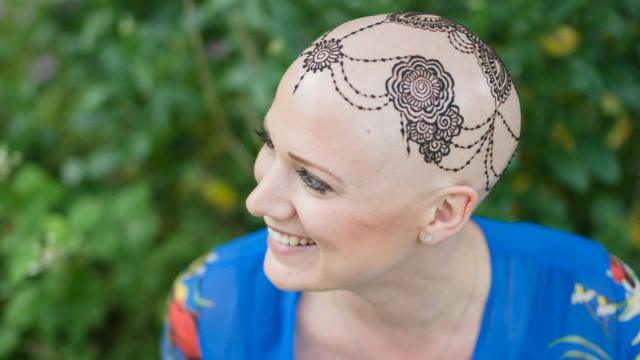 Alopecia patient calls for bald emoji to help represent hair loss - BBC News