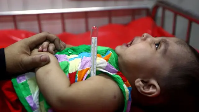 হাসপাতালে শিশুর জ্বর পরীক্ষা করা হচ্ছে।