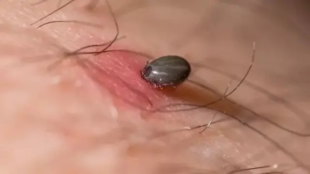 เห็บไม่ใช่แมลง แต่เป็นปรสิตภายนอกที่ดูดเลือดได้โดยเหยื่อไม่เจ็บและไม่เกิดการอักเสบ