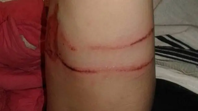 Эсенжан кызы Элнура: Балам кыйкырып, "атамды карышкыр тиштеди" деп чуркап келгенинен, ишенбей сыртка чыга калсам, күйөөм карышкыр менен алышып аткан экен.