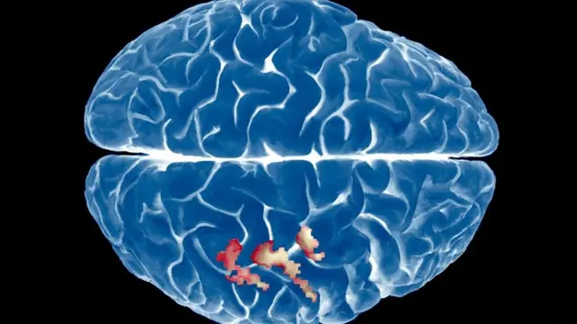 Функціональна магнітно-резонансна томографія