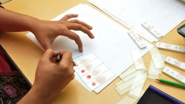 వ్యాధి లక్షణాలు బయటపడిన వెంటనే చికిత్స ప్రారంభించాల్సి ఉంది