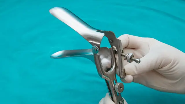Un espéculo vaginal