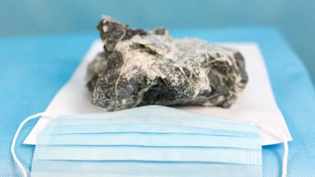 Piedra de asbesto
