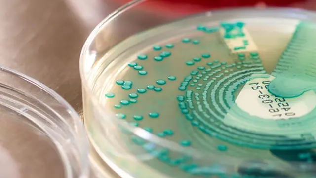 ایم ار ایس اي څېړنه